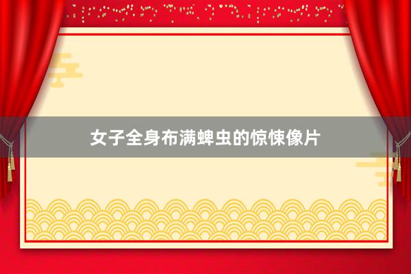 女子全身布满蜱虫的惊悚像片